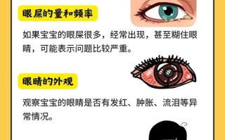 新生儿眼屎多，是上火还是生病了？