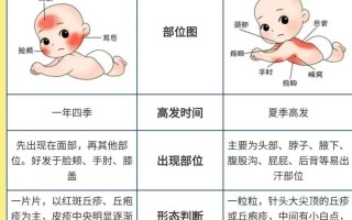 新生儿湿疹到底能不能洗澡？洗澡时要注意哪些问题才能避免加重？