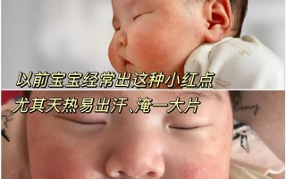 新生儿脸上红血丝多，是正常生理现象还是皮肤疾病信号？