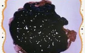 孕期大便发黑是正常现象还是身体预警？需要警惕哪些潜在健康风险？