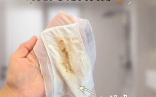 孕期内裤见血是何原因？