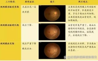 新生儿眼底血管几周能发育好？