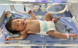 新生儿黄疸值多高必须住院？照光治疗期间家长要注意什么？