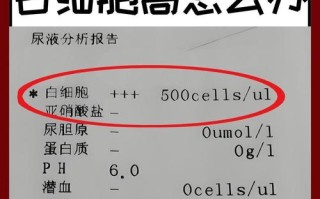 孕期尿液检查白细胞高是感染了吗？对胎儿有影响吗？