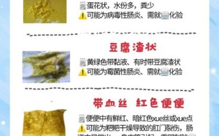 新生儿几天不大便是否正常？需要警惕哪些异常情况？