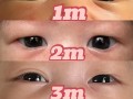 新生儿半睁眼时显现双眼皮，长大后眼型会因此变化吗？