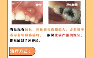 儿童牙龈鼓包怎么回事
