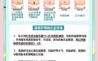 新生儿肚脐可以用双氧水消毒吗