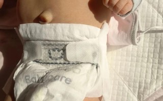 新生儿肚脐眼突出红肿是感染还是正常现象？该如何处理？