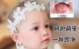 新生儿需清洁口腔舌苔吗？