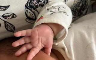 为什么新生儿唯独手部肤色白皙，身体其他部位颜色较深？