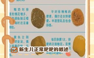 新生儿每天拉几次大便算正常