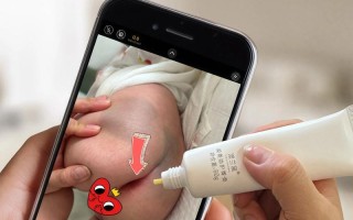 新生儿屁股红到底该擦什么药才安全有效？