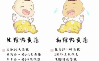 新生儿黄疸出现哪些症状会危害健康？需警惕哪些异常信号？