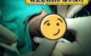 儿童包皮手术后恢复过程图解，不同阶段伤口变化该如何观察护理？