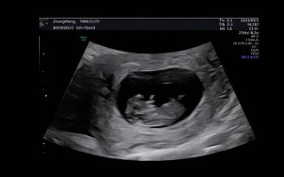 孕期50天B超显示蝌蚪状，是正常胚胎发育还是异常情况？