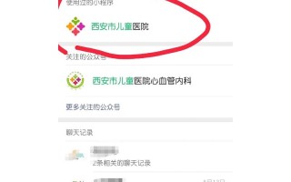 西安儿童医院免费咨询具体怎么操作？需要提前预约吗？