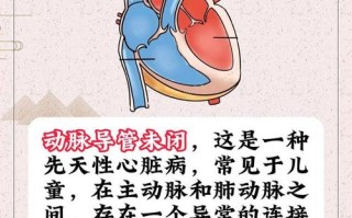 新生儿动脉导管、卵圆孔未闭，要干预吗？