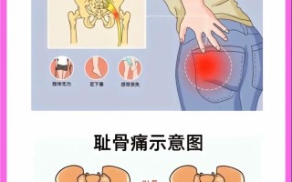怀孕期间为什么屁股疼