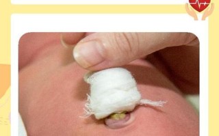 新生儿脐疝一定要手术吗？有哪些非手术治疗方法有效？