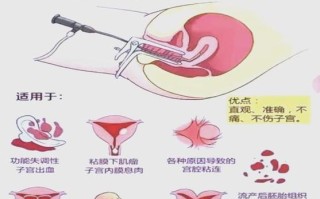 怀孕期间能检查宫颈吗