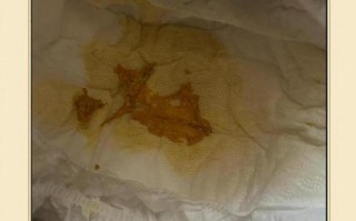 新生儿放屁带大便，是正常现象吗？