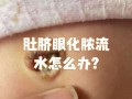 新生儿肚脐未脱落且有脓，是感染还是正常现象？该如何处理？
