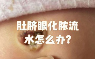 新生儿肚脐未脱落且有脓，是感染还是正常现象？该如何处理？