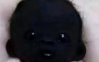 新生儿肤色突然变深是正常现象吗？需警惕哪些健康问题？