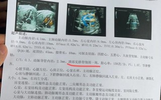 孕期必须做心脏彩超吗？哪些情况需要重点检查？对胎儿和孕妇有影响吗？