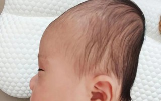 新生儿头总偏向一边睡，是正常习惯还是需要警惕的斜颈信号？