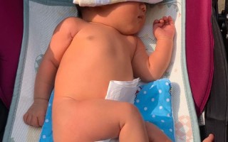 新生儿13天黄疸15mg/dl需要干预吗？正常范围是多少？