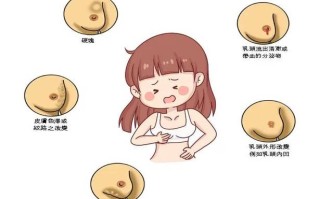 孕期乳头分泌物出现异味是正常现象吗？会对胎儿或哺乳有影响吗？