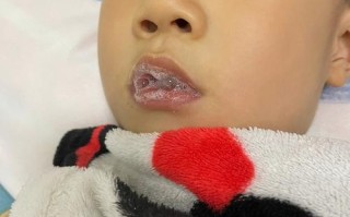 新生儿吐泡泡是正常现象吗？需警惕哪些问题？