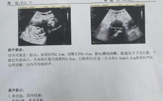 孕期三维彩超单怎么看