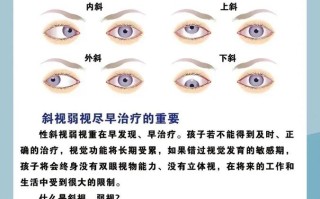 儿童眼睛弱视到底能不能治好？最佳治疗期是什么时候？