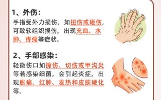 孕期手指关节痛，是缺钙还是激素变化？