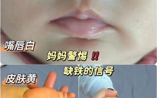 新生儿吃完奶嘴唇发白是正常现象还是缺氧信号？需警惕哪些潜在问题？