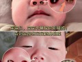 15天新生儿流鼻涕鼻塞怎么办？需要用药还是能自愈？