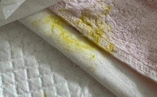 新生儿吐奶出现黏状物是正常现象还是疾病信号？附图片解析。