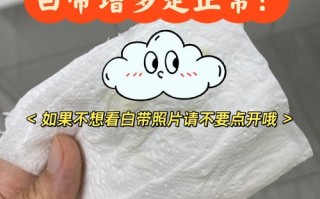 孕期白带发黄无异味无瘙痒要紧吗？