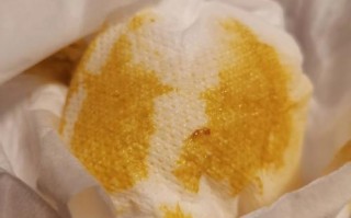 新生儿血里有细菌感染，这究竟是怎么发生的？又该如何应对？