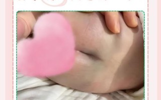 新生儿尾骨处有个小洞是先天畸形吗？需要治疗吗？