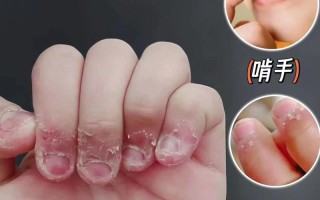 新生儿啃手指是饿了还是习惯？家长该如何科学应对？