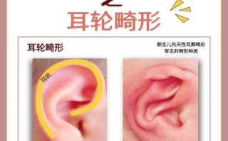 新生儿耳轮粘连该矫正吗？