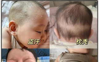 新生儿囟门大一定是缺钙吗？还有哪些可能原因需要警惕？