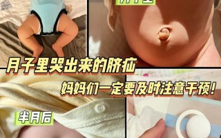 新生儿脐疝一般多久能自行愈合？家长日常护理要注意哪些事项？