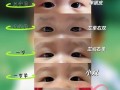 新生儿多久看出双眼皮