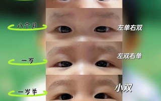 新生儿多久看出双眼皮