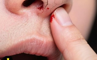 孕期鼻腔出血是身体异常信号吗？需警惕哪些潜在健康风险？